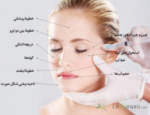 قیمت ژل رووفیل اولترا