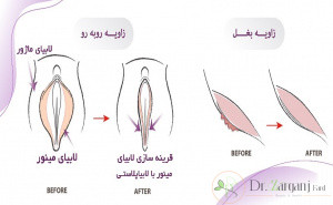 هزینه