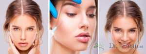 تکنولوژی رووفیل