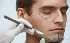 2:نحوی جراحی لیفتیگ صورت چگونه است ؟