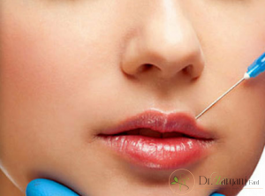 انواع ژل تزریقی صورت چند نوع هستند؟