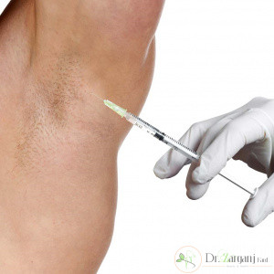 قبل از تزریق بوتاکس چه مواردی را باید رعایت شود؟