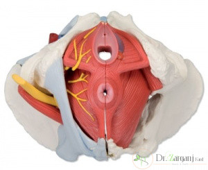 درمان قطعی واژینیسموس