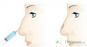 قیمت تزریق ژل به بینی