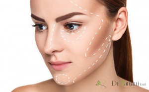 کول لیفتینگ چیست ؟