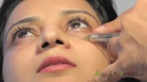 روش تزریق فیلر برای از بین بردن سیاهی  ایجاد شده دورچشم، توضیح دهید؟