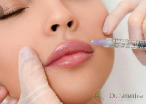 تزریق ژل لب درد دارد ؟