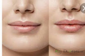 چند نوع ژل لب داریم؟