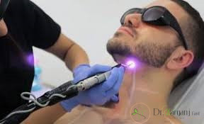 موانع استفاده از لیزر ایلایت در چه کسانی می باشد؟