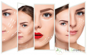 کول لیفتینگ چیست ؟