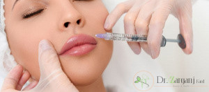 قیمت ژل هیالورونیک اسید