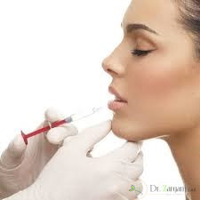 2ـ چگونه ژل را در لب ها تزریق می کنند؟