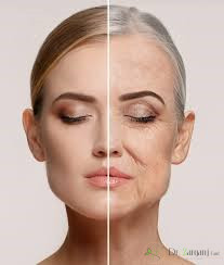 ژل رووفیل کره چیست؟