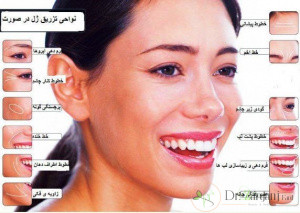 ژل را در چه نواحی از بدن می توان استفاد کرد؟