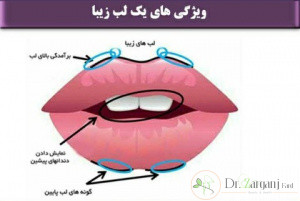 مراقبت بعد از ژل لب چگونه است؟