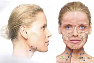 شماره 3: آیا ممکن است برای رفع خطوط افقی گردن راه حل های طبیعی وجود داشته باشد؟