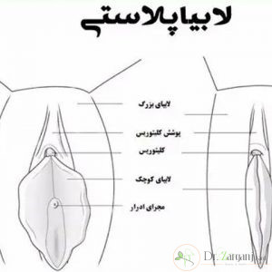 عمل لابیا در اصفهان