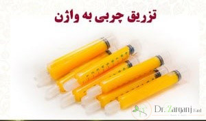 تزریق چربی به لابیا ماژور تا چه مدت ماندگاری دارد؟