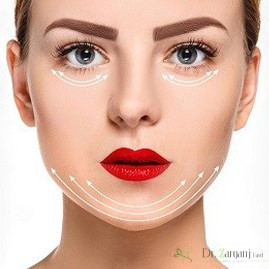 زاویه دار کردن صورت با نخ لیفتینگ
