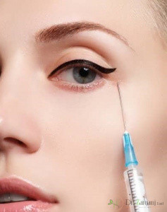 2ـ حفره زیر چشم به چه معنا است؟