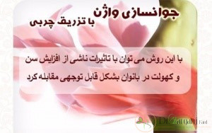 مراقبت های بعد از این تزریق چیست؟