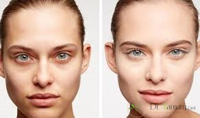 تزریق ژل در پوست صورت چه کاربردهایی می تواند داشته باشد؟