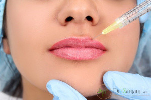 پس از تزریق ژل لب چه علائمی ممکن است پدیدار شوند؟