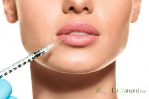  در تزریق ژل هر ناحیه از صورت به چه میزان ژل احتیاج دارد؟