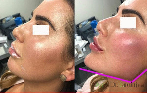 از ژل پرفکتا برای کدام قسمت از بدن می توان استفاده کرد؟
