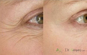 ویژگی ژل پرفکتا کامپلیمنت چیست؟