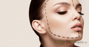 تأثیر ژل الانسه