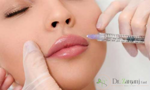 ویژگی بهترین دکتر برای تزریق فیلر: