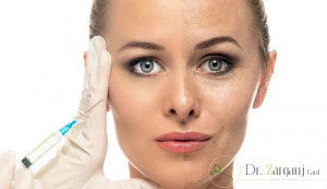 چه افرادی باید تزریق ژل صورت را انجام دهند؟