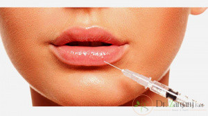 زمان استفاده مجدد از تزریق ژل لب چگونه است؟