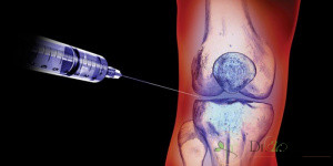 عوارض جانبی تزریق ژل در زانو: