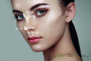 3: نخ های لیفت بینی چه ویژگی هایی دارند؟
