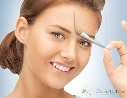 بهترین دکتر برای درمان جای جوش چه ویژگی هایی دارد؟