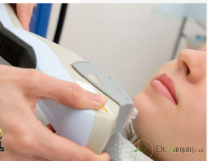 لیزر کندلا برای چه نوع پوستی مناسب است؟