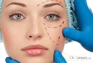چه تذکراتی را باید بعد از انجام زاویه دار کردن به یاد داشت؟