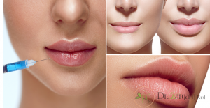 نکاتی که باید قبل از تزریق ژل به آن توجه کرد؟