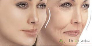 مشخصات ژل آیدیا چیست؟