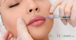 کاربرد های ژل الانسه چیست؟
