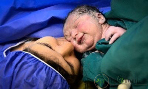 زایمان طبیعی و سزارین چه تفاوت هایی با یکدیگر دارند؟