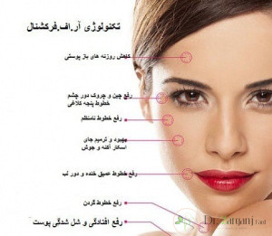 مزایای استفاده از ار اف چیست؟