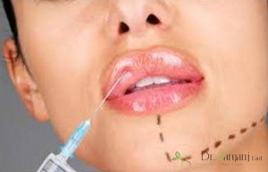 انتخاب یک کلینیک مناسب برای تزریق ژل چه تأثیری در کیفیت این عمل دارد؟