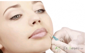 هزینه تزریق ژل لب دائمی چقدر است ؟