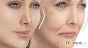 قیمت ژل لب رووفیل پلاس