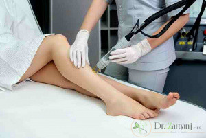 2) مزایای دستگاه لیزر موتوس را ذکر کنید؟