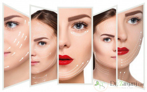 لیفت ابرو برای چه کسانی مناسب است؟