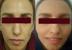 عامل ایجاد محصولات متنوع ژل ژوویدرم توسط کشور های دنیا چیست ؟